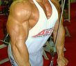 Triceps